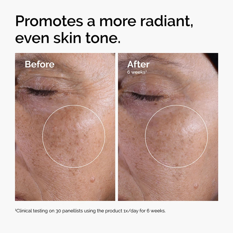 The Ordinary - Tónico exfoliante Glycolic Acid 7% de 240 ml